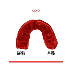 Tandbeskytter - Gold 2022 Edition