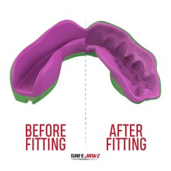 Tandbeskytter MARVEL - HULK