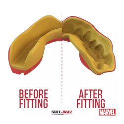 Tandbeskytter MARVEL - Iron Man