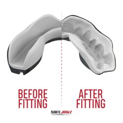 Tandbeskytter MARVEL� - Venom